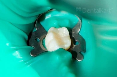 Waldent Rubber Dam Clamps - Adult