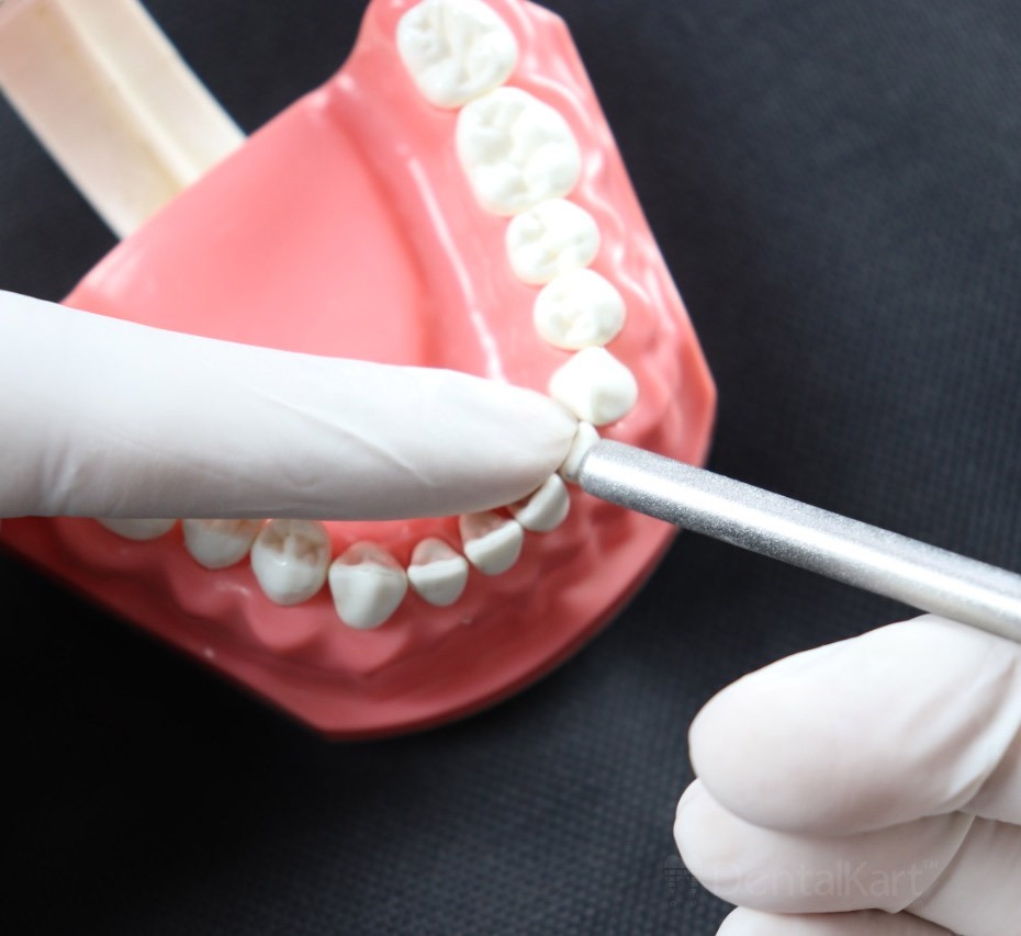 Waldent Mouth Mirror with Premium Handle (13/110)