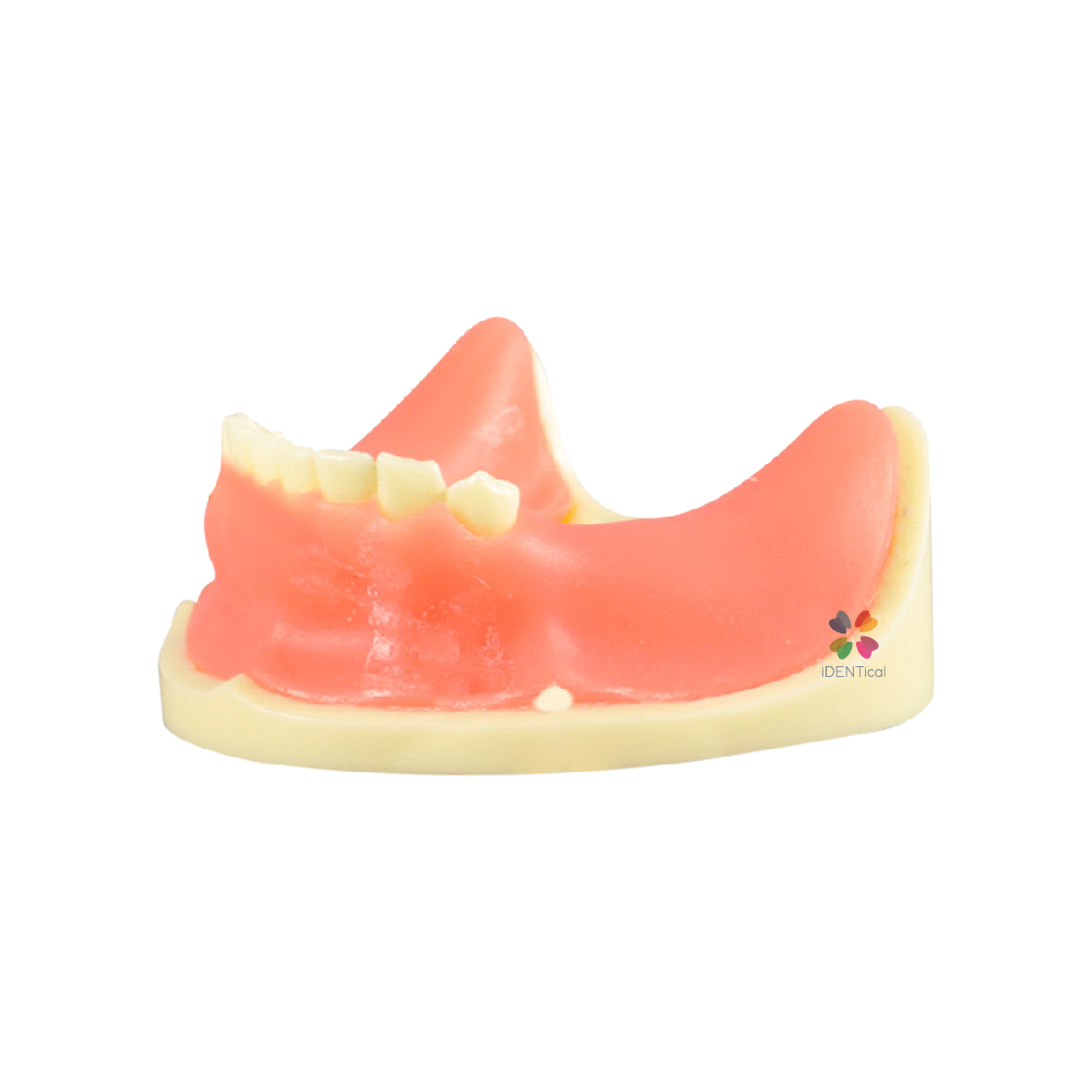 iDENTical Dental Implant Practicing Model Mandible M2009