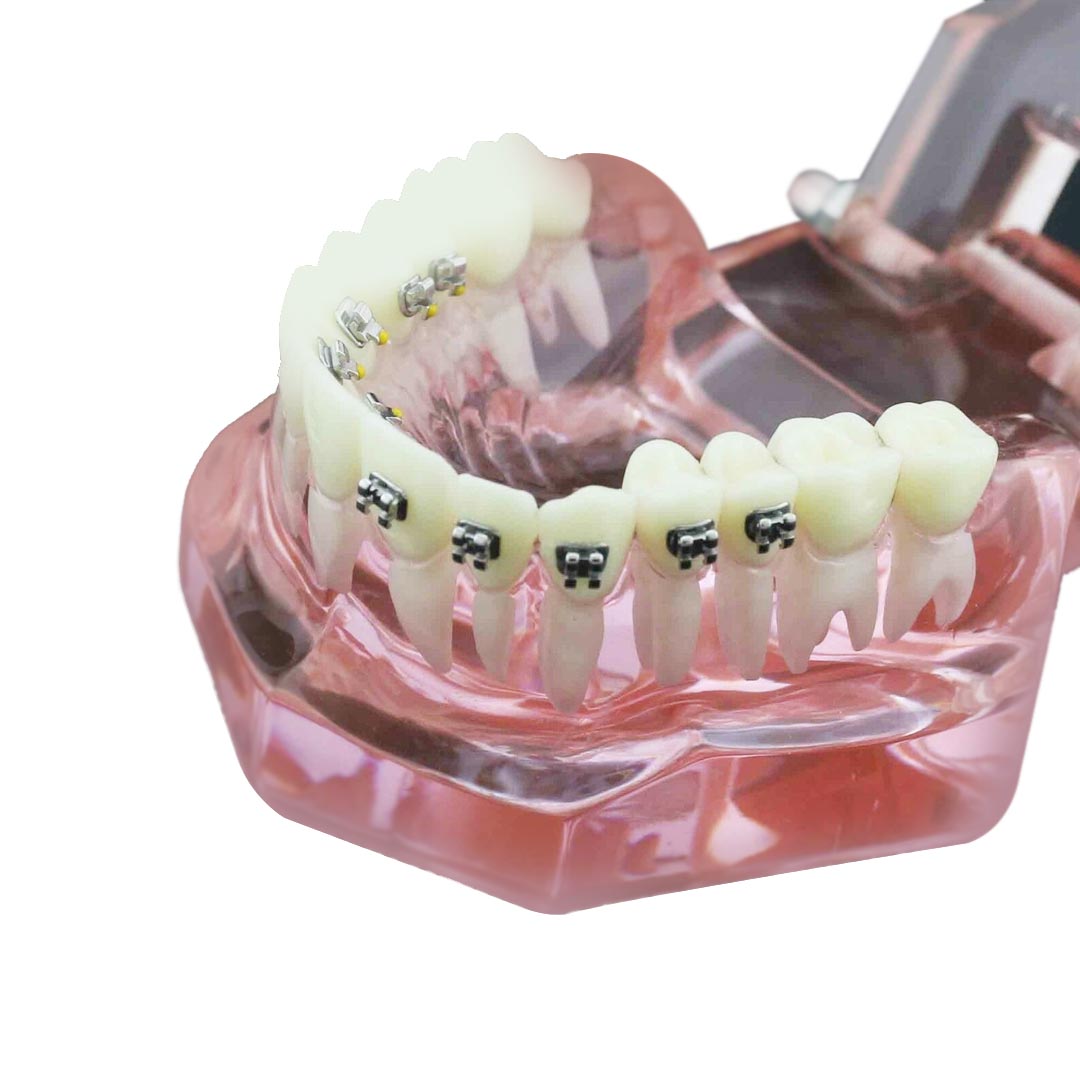 iDENTical Self Ligating Models M3012