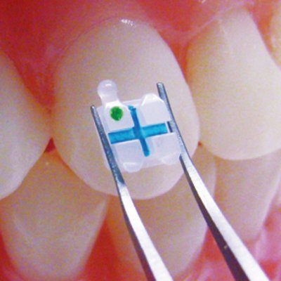 3m Unitek Clarity Advanced Ceramic Brackets