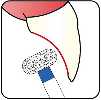 Mani Diamond Airotor Burs - Wheel Round Edge / Wr Series