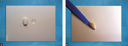 Wizdent Secure GI Fill Extra 9 GIC