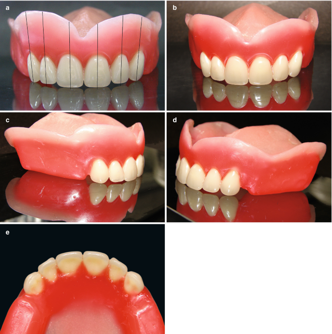 2GM PrestoRock Teethset A2 (Pack of 4 Sets)