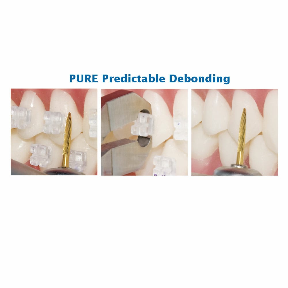 UU Ortho Mono Crystalline Sapphire Transparent Ceramic Brackets