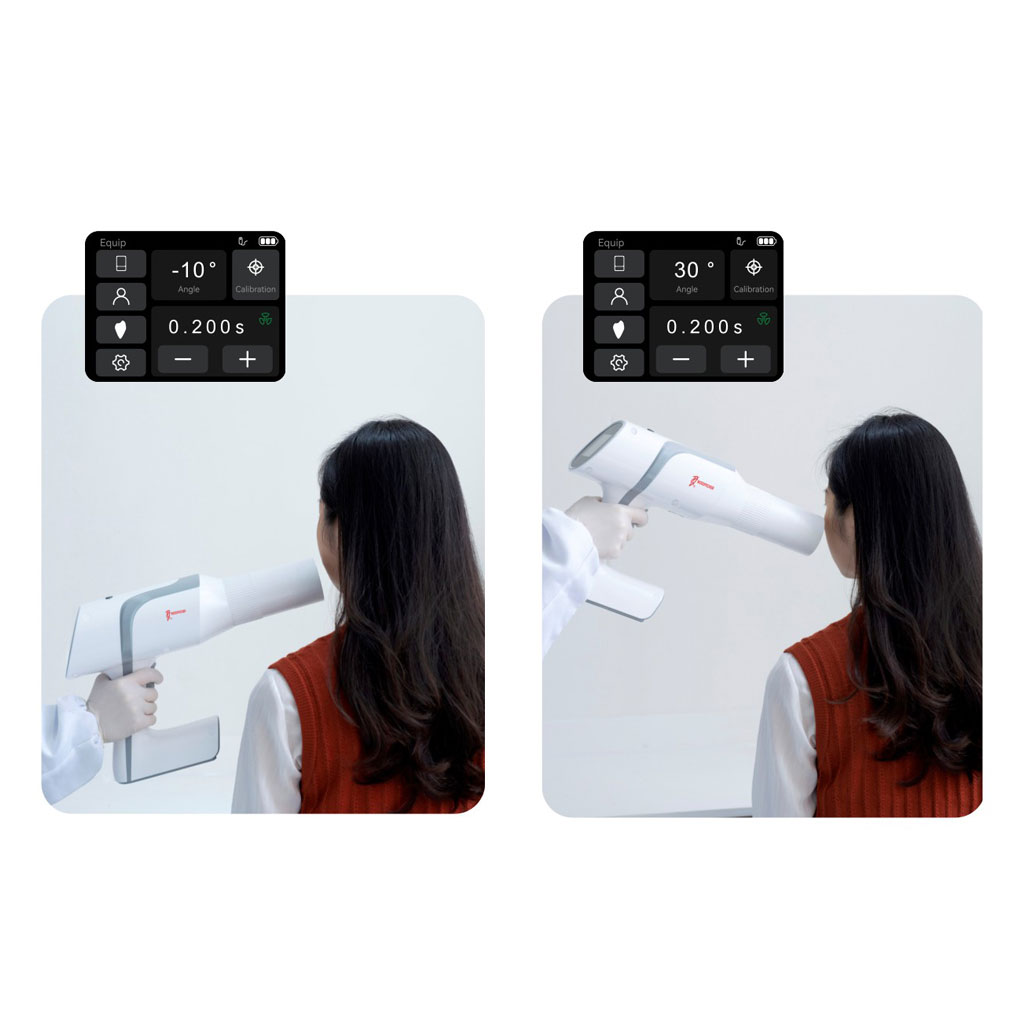 Woodpecker Ai Ray Portable X-Ray Machine