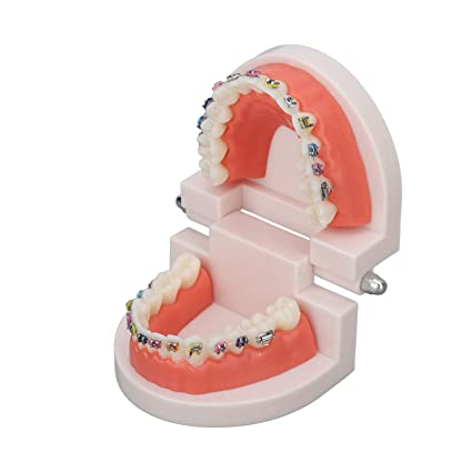 Patient Education Model With Orthodontic Brackets MD-119