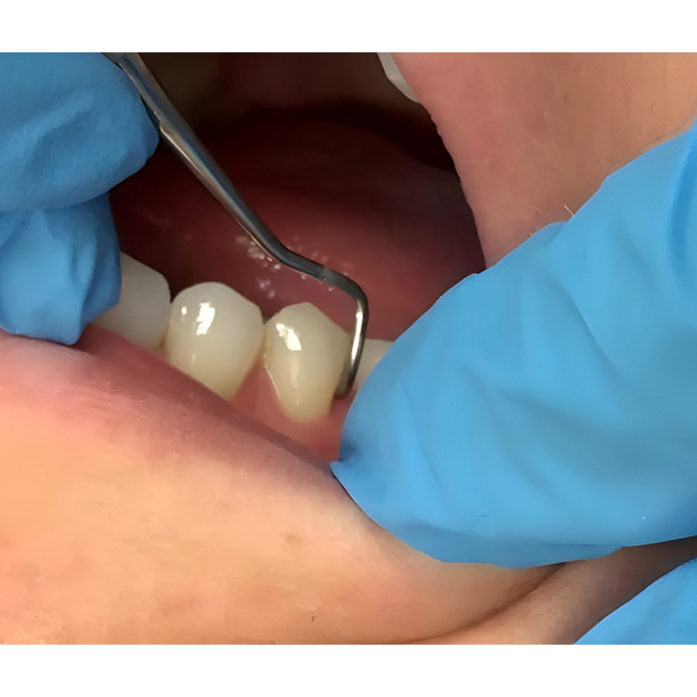 Oracraft Conservative Kit Instruments Set Of 19 In Pouch - CIP19