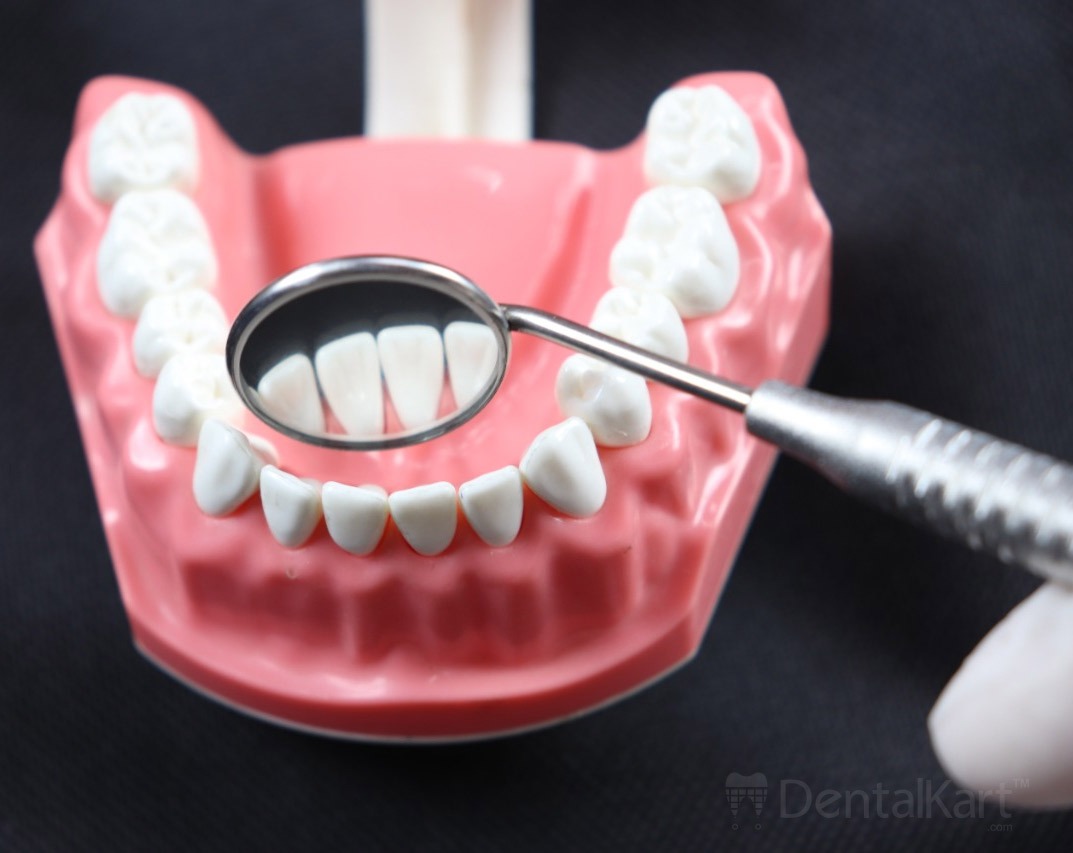 Waldent Mouth Mirror with Premium Handle (13/110)