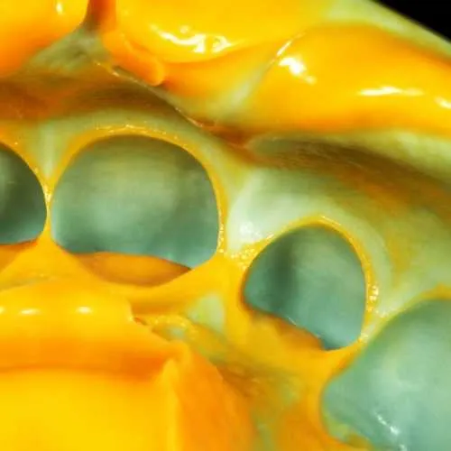 Zhermack Zetaplus 10Kg Bucket