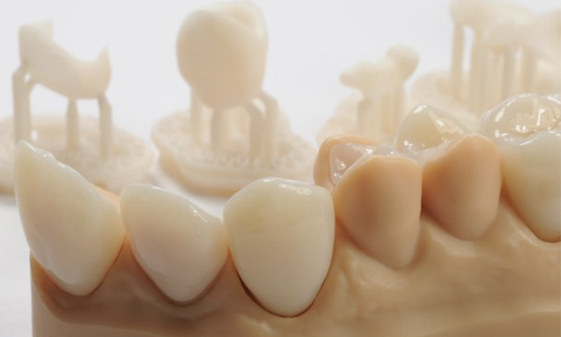Arma Dental 3D Printing Resin - Temp (1 KG)  