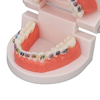 Patient Education Model With Orthodontic Brackets MD-119