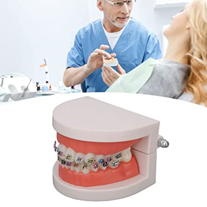Patient Education Model With Orthodontic Brackets MD-119