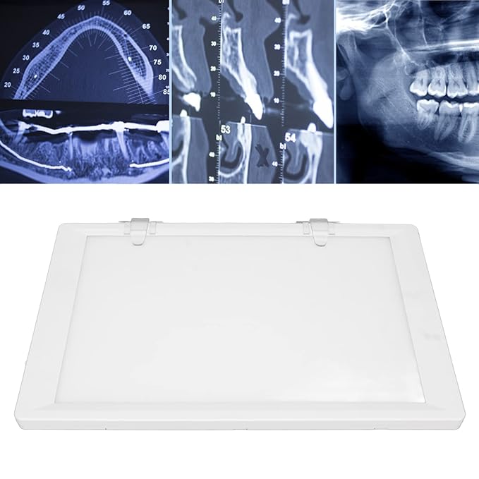 Sparedent Panoramic X-ray Viewer - Chair Mount