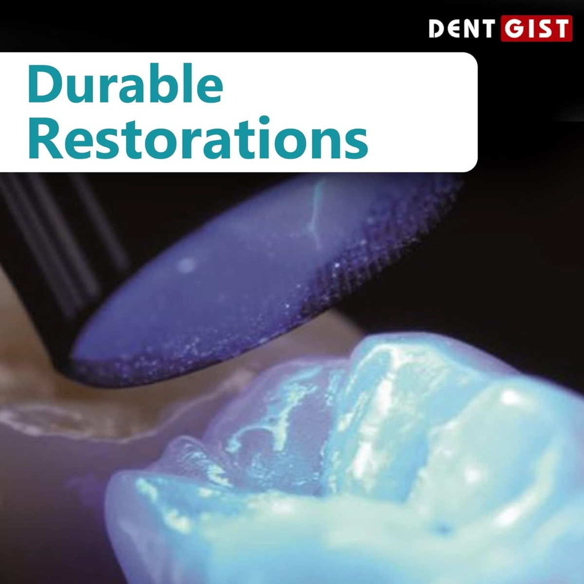 DentGist NanoCom Restorative Composite Refills 4g