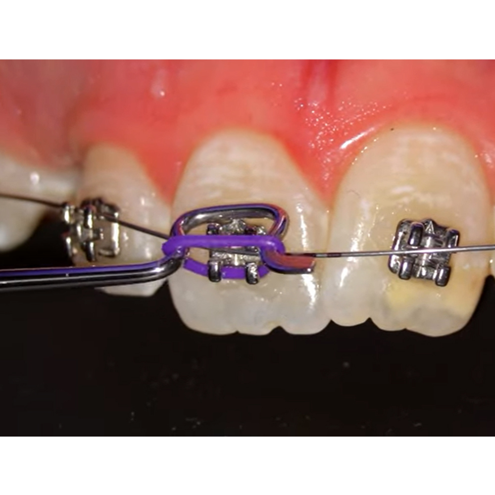 GDC Ortho Elastic Ligature Applicator #1 (674)