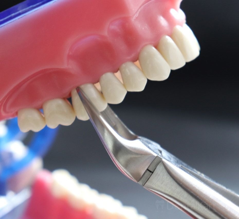 Waldent Tooth Extraction Cowhorn Forceps Upper Molars Right No.89 (1/115)