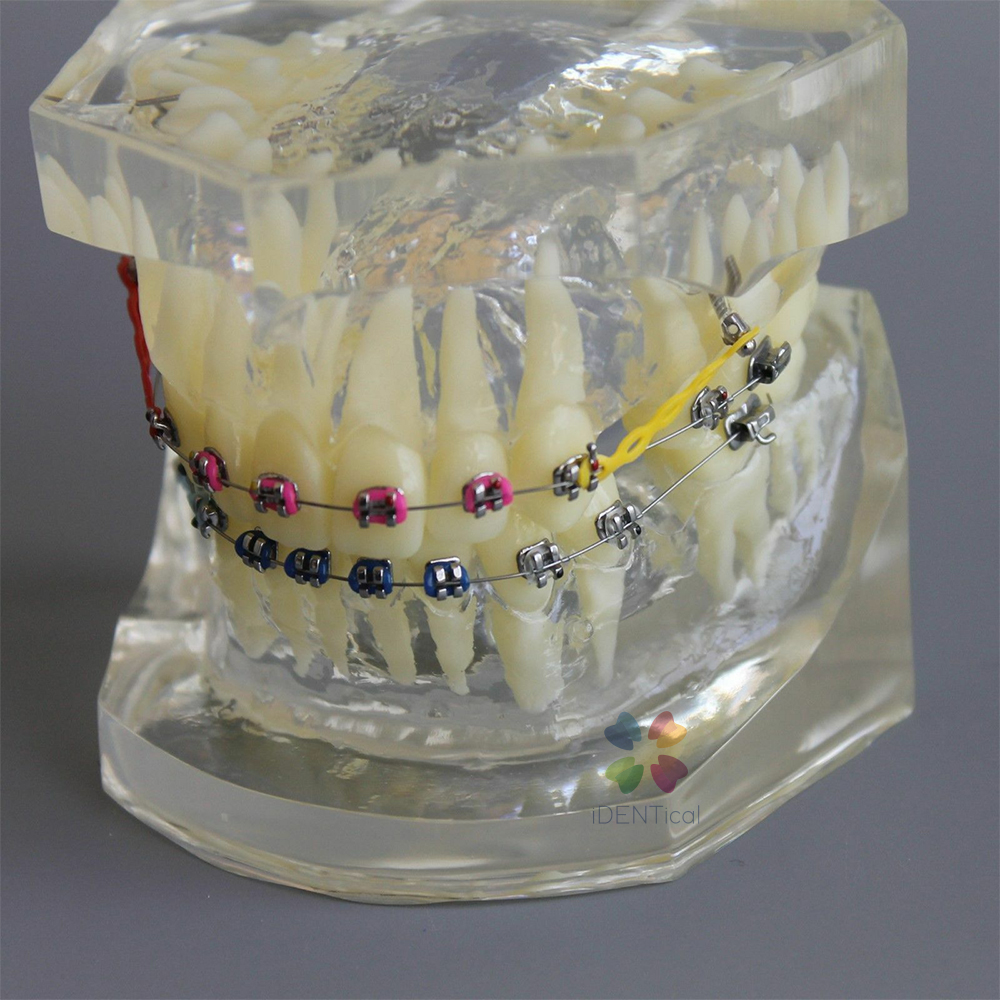 iDENTical Dental Orthodontic Models M3005
