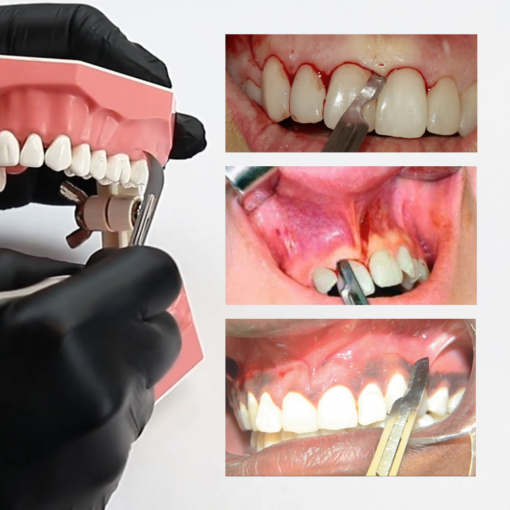 Waldent Scalpel Handle Rotatable 180° NO.3 (9/114)