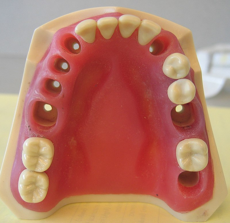 API Jaw Set with Typodonts 