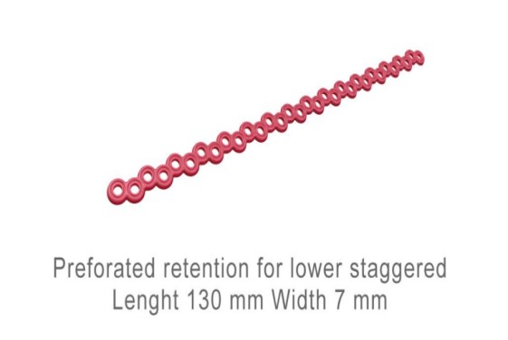 Dentaurum Waxes Retentions Red