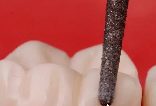 Prima Dental Predator Zirconia Cutting Bur 856 (Pack of 5)