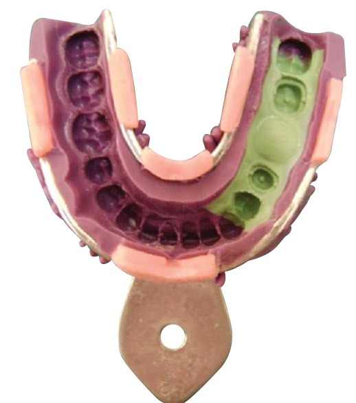 Waldent Dentulous Perforated Rim Lock Impression Trays K18/3