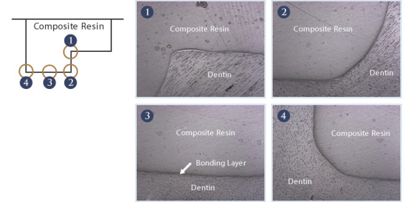 Tokuyama Palfique 7th Generation Bond 5ml