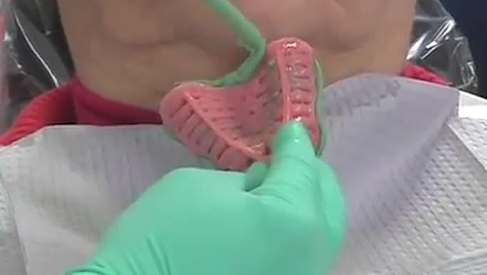 Nobilium Massad Edentulous Low Temp Tray Intro Kit Pack of 12