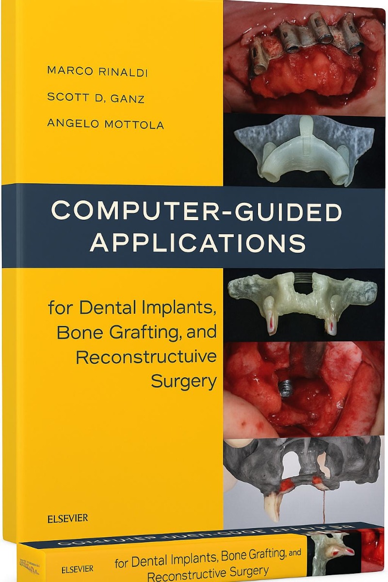 Computer-guided Applications For Dental Implants, Bone Grafting, And Reconstructive Surgery 1st Edition (ISBN - 278034)