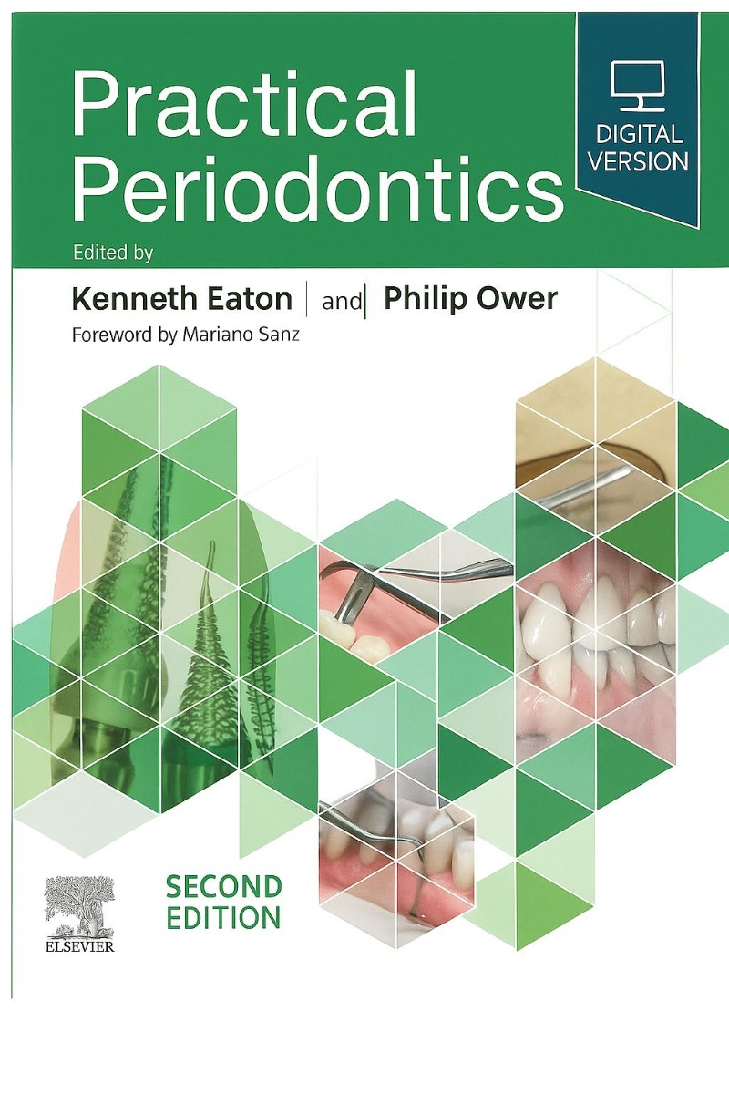 Practical Periodontics 2nd Edition (ISBN - 878456)