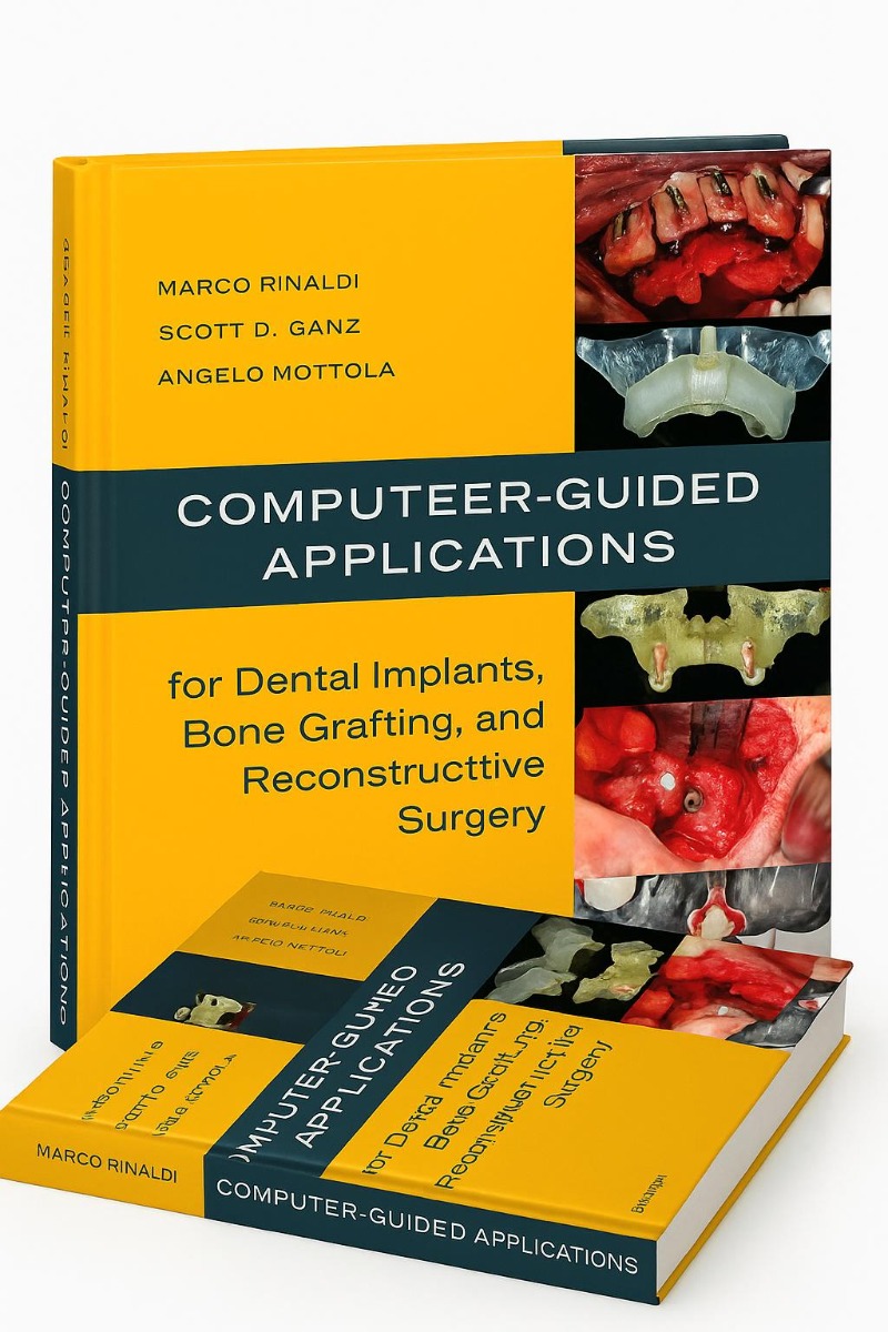 Computer-guided Applications For Dental Implants, Bone Grafting, And Reconstructive Surgery 1st Edition (ISBN - 278034)
