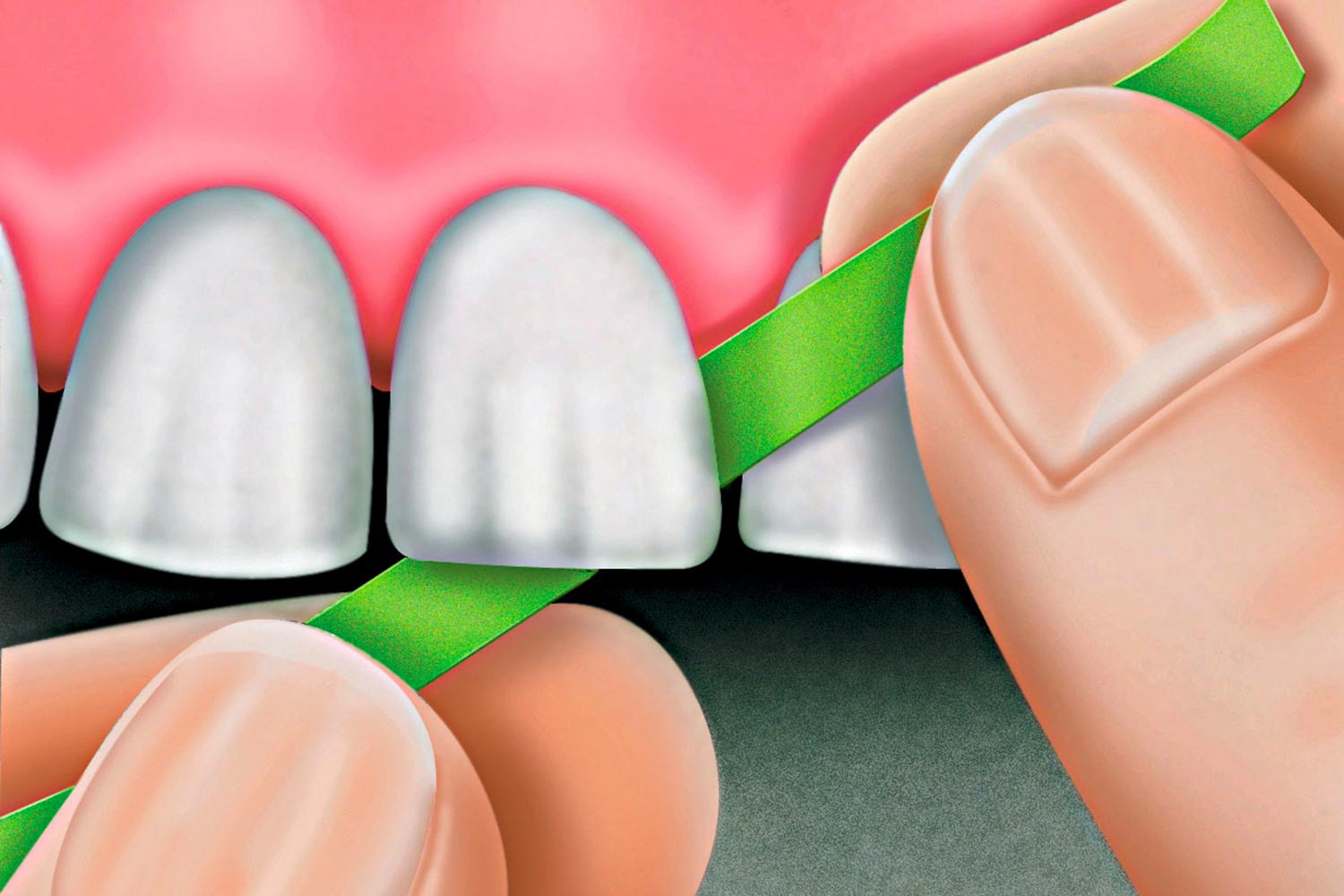 Tor Vm Polishing Strips