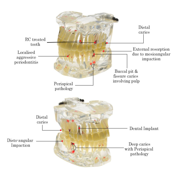 iDENTical Adult Pathologies Model M4001-1