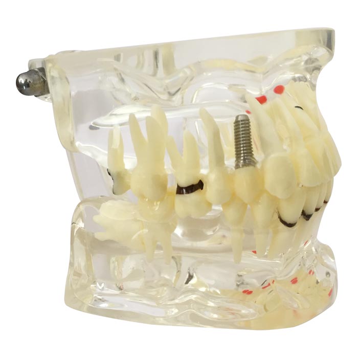 iDENTical Adult Pathologies Model M4001-2