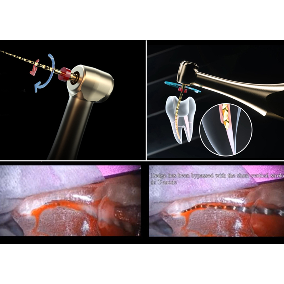 Woodpecker Ai - Motor Endomotor With Apex Locator