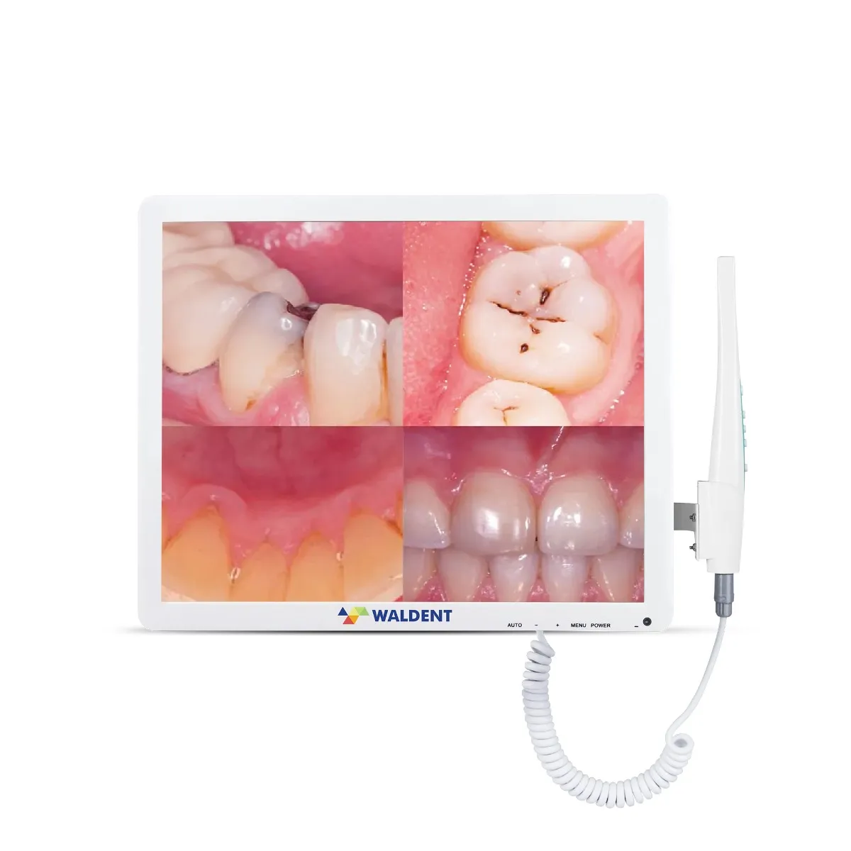 Waldent Intraoral Camera Smart -Cam with PMS