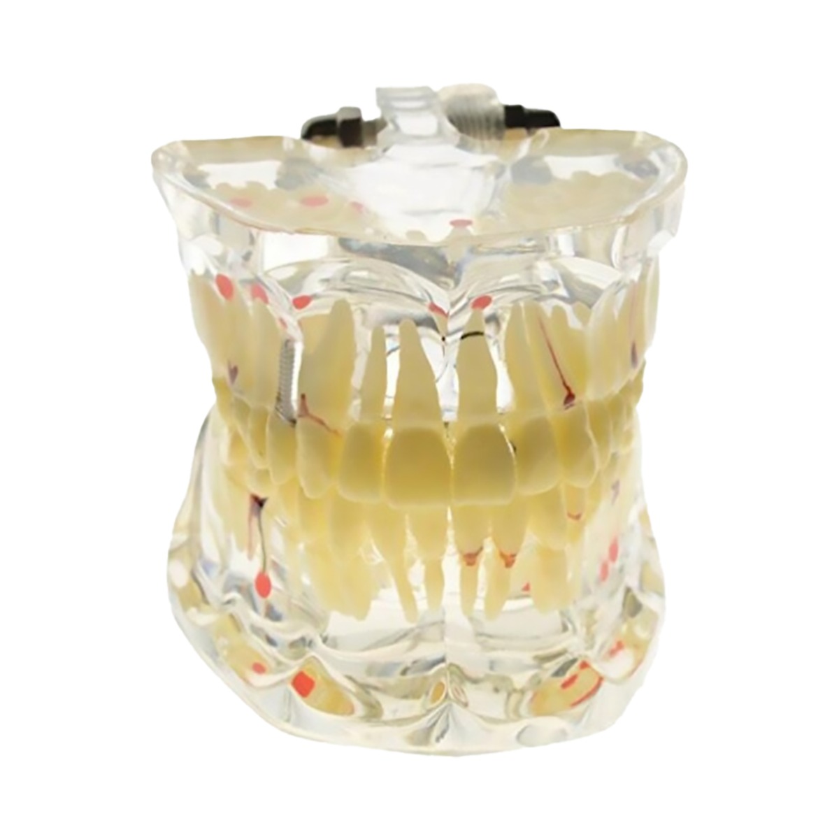 iDENTical Adult Pathologies Model M4001-1