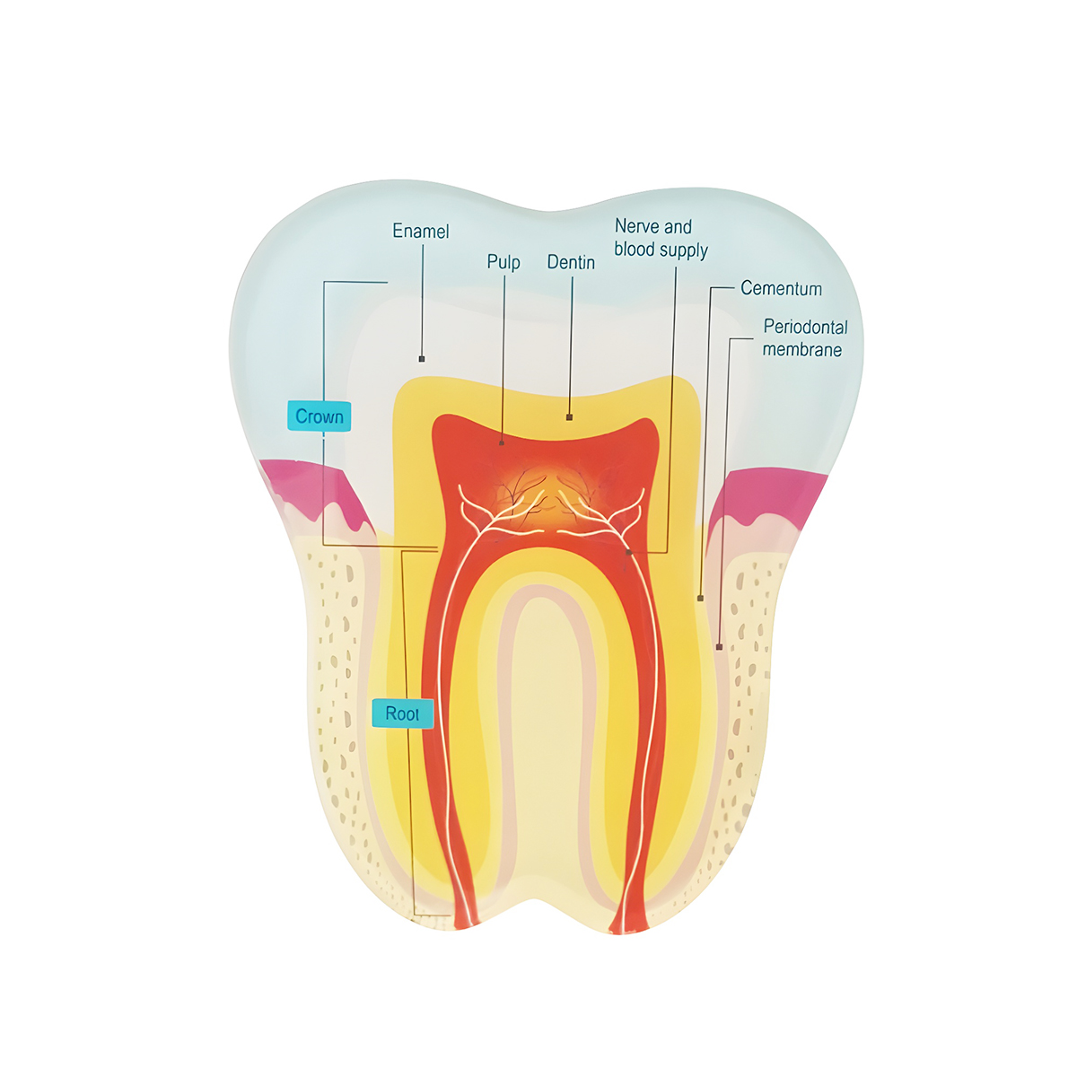 Ivory Tooth Shape Paper Weight - Normal Tooth Vs Carious Tooth