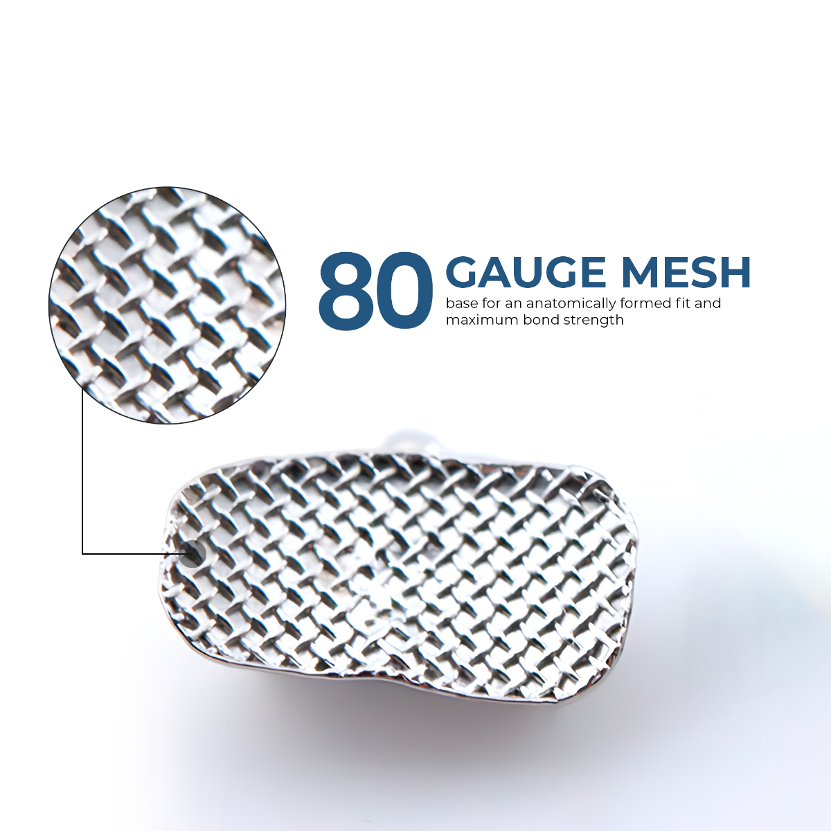 Waldent Ortho Bondable Buccal Tubes MBT 0.022 (Pack of 20 Sets)