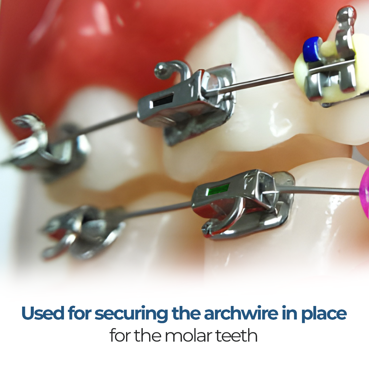 Waldent Ortho Bondable Buccal Tubes MBT 0.022 (Pack of 20 Sets)