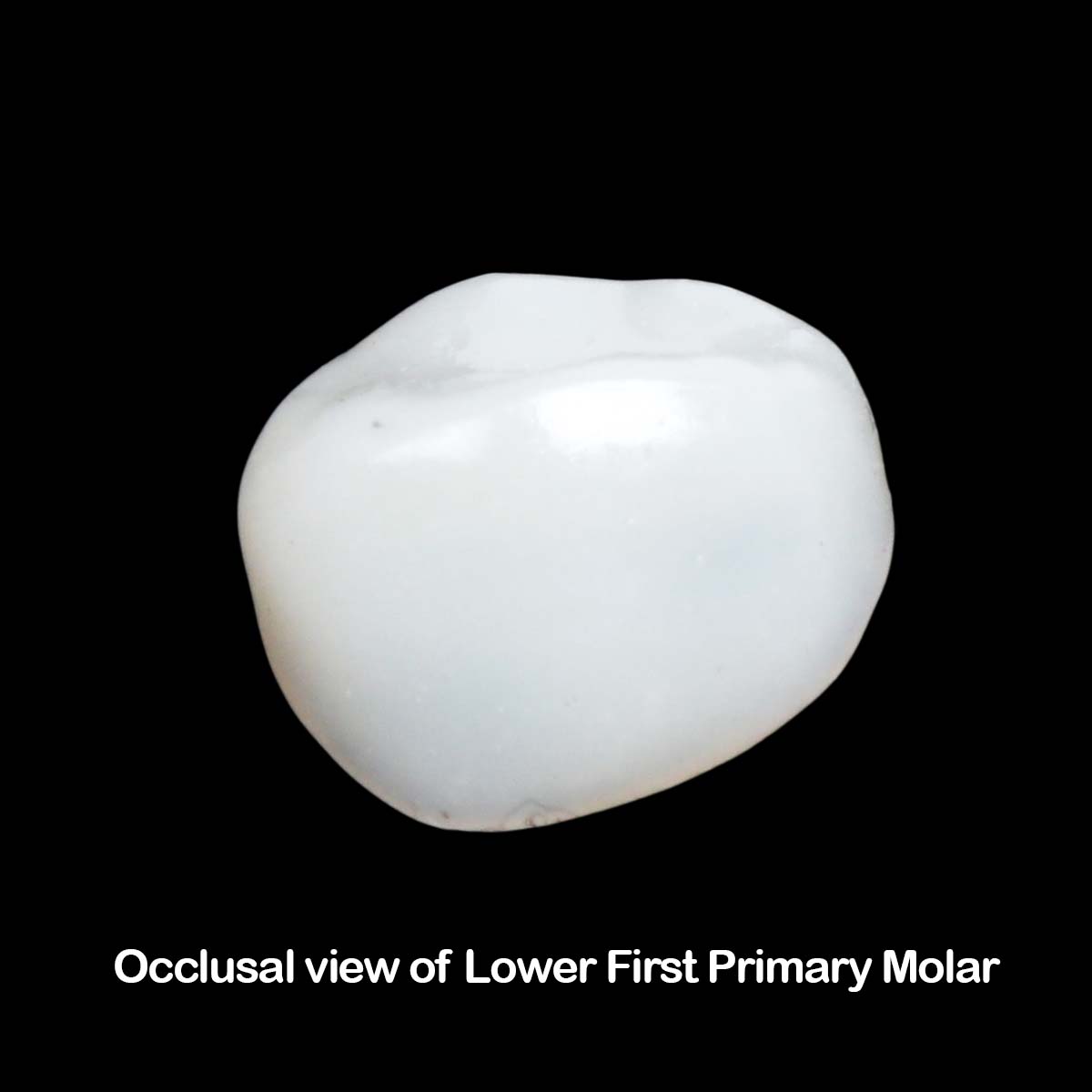 Pedo Crown Primary Molar Mini Kits