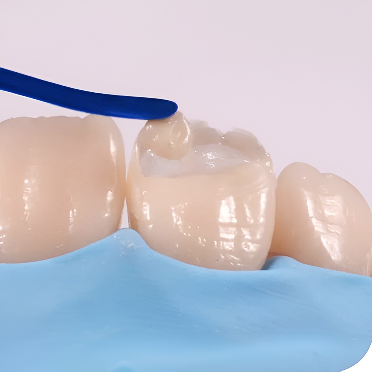 Waldent Composite Instrument WPB-1-T-14/101