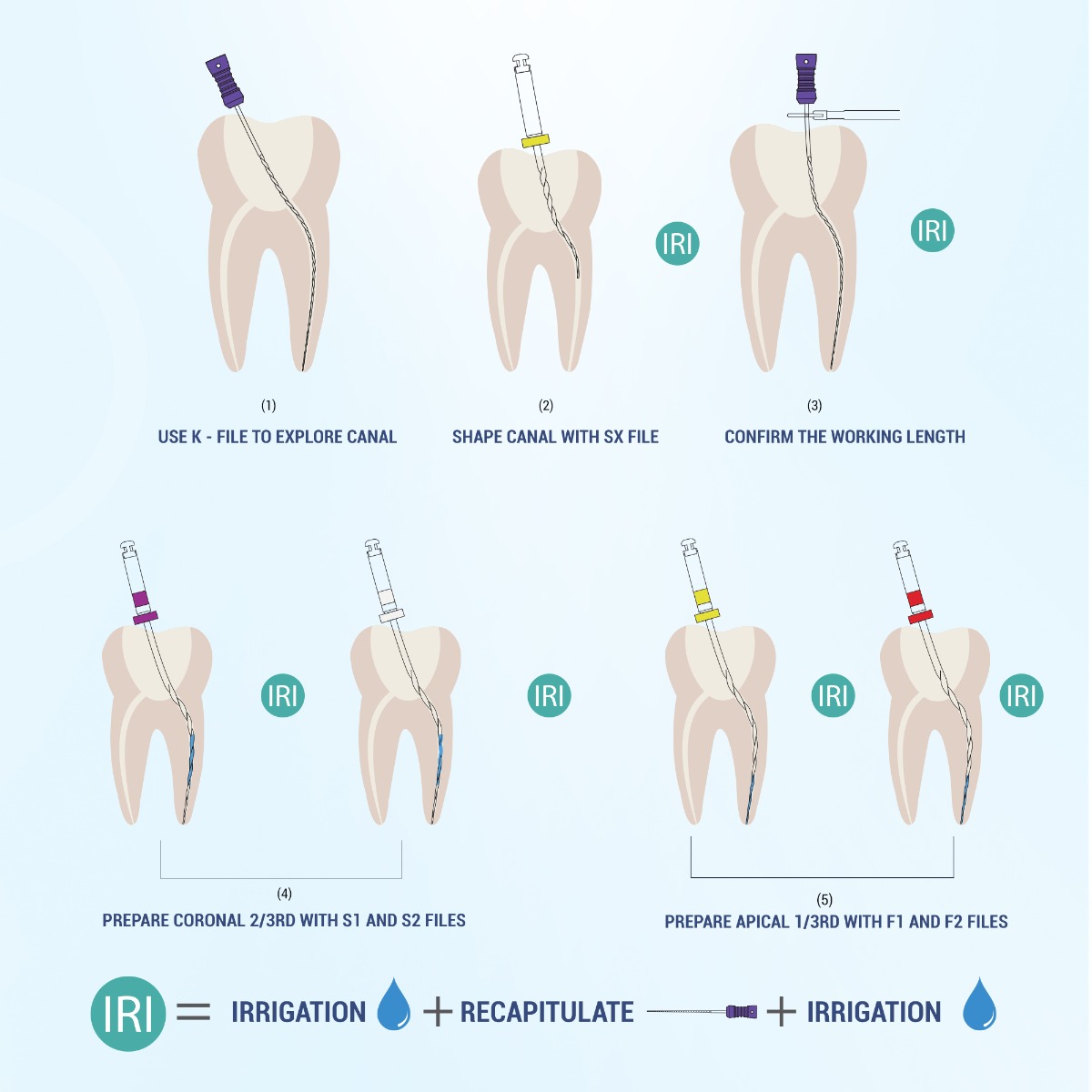 Endo Excellence Nano Gold Rotary Files -21mm (Pack of 6)