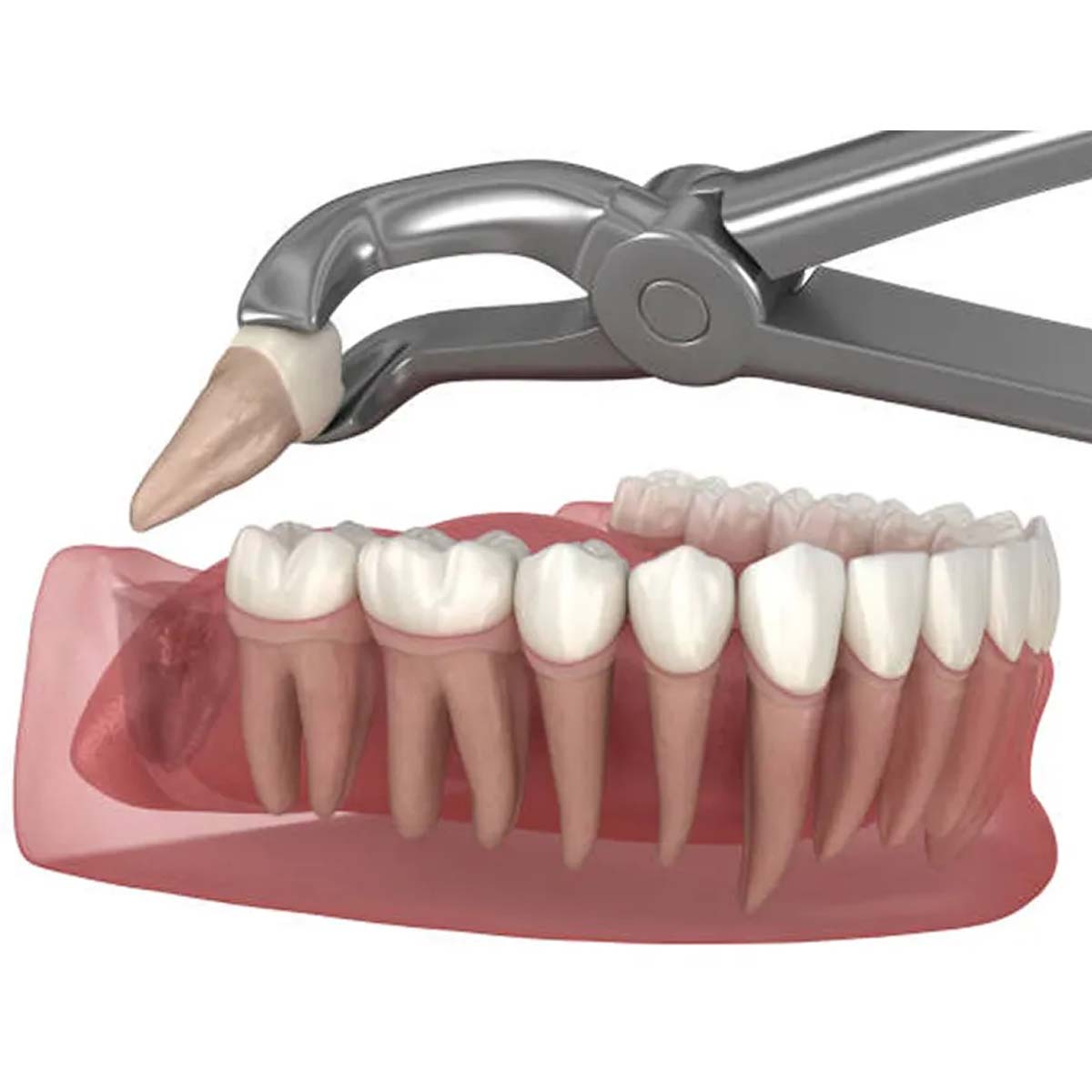 Oracraft Extraction Forceps