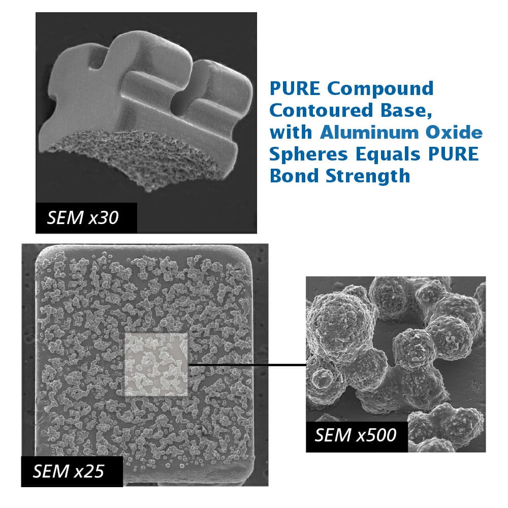 UU Ortho Mono Crystalline Sapphire Transparent Ceramic Brackets