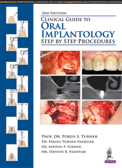 Jaypee Medical Clinical Guide to Oral Implantology: Step by Step Procedures (ISBN - 704279)