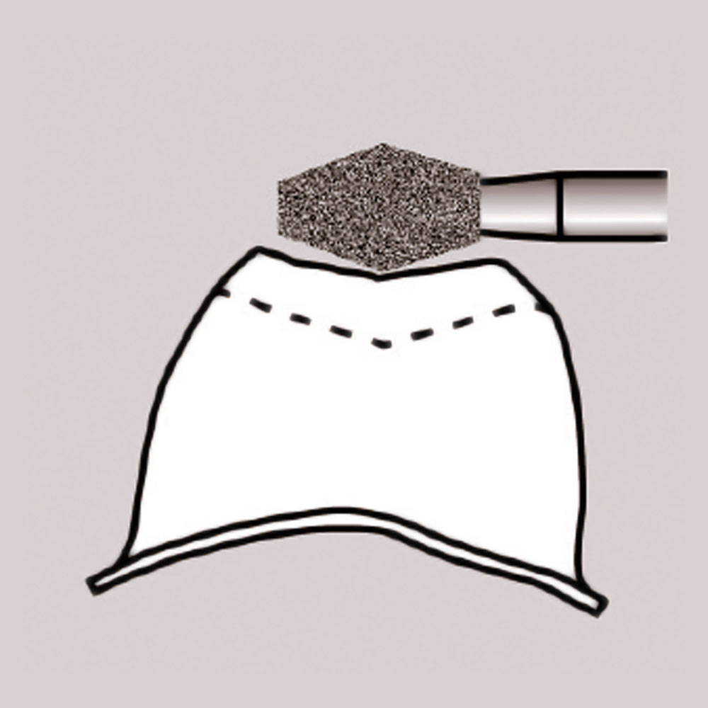 Frank Dental Barrel Diamond Bur EX (Made in Germany)