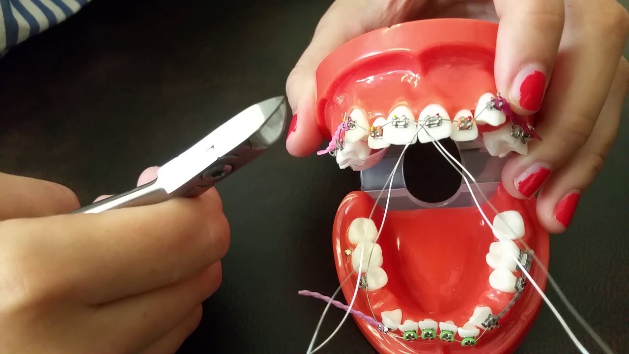 Waldent Orthodontic Kit Classic Set of 11 (K10/2)