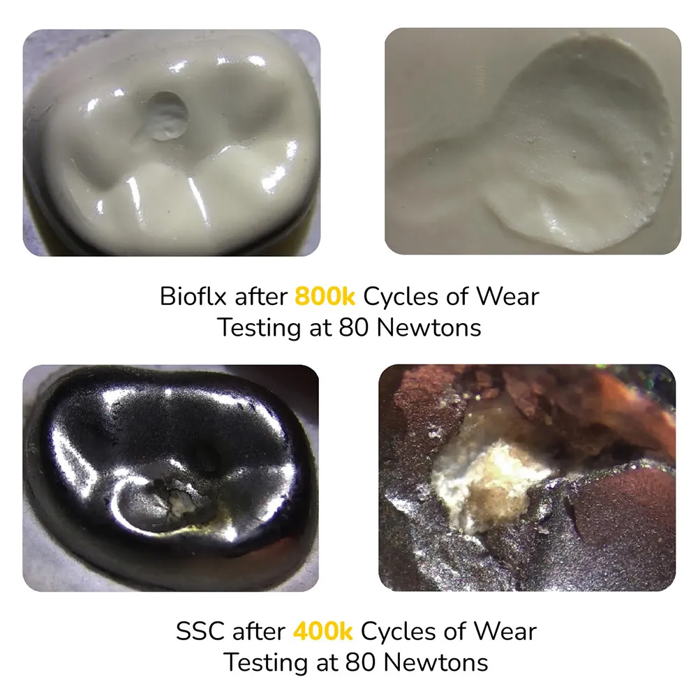 Kids-e-Dental BioFlx Upper Left 1st Molar Crowns Refills